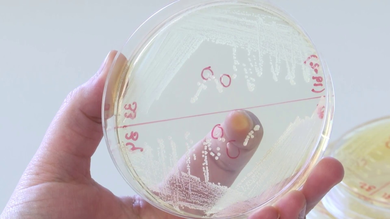 La resistencia a los antibióticos. Un problema que nos afecta a todos